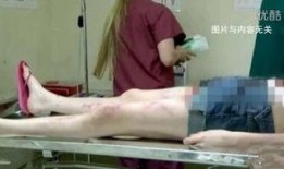 尸体解剖在线观看,揭秘生命终结的神秘面纱